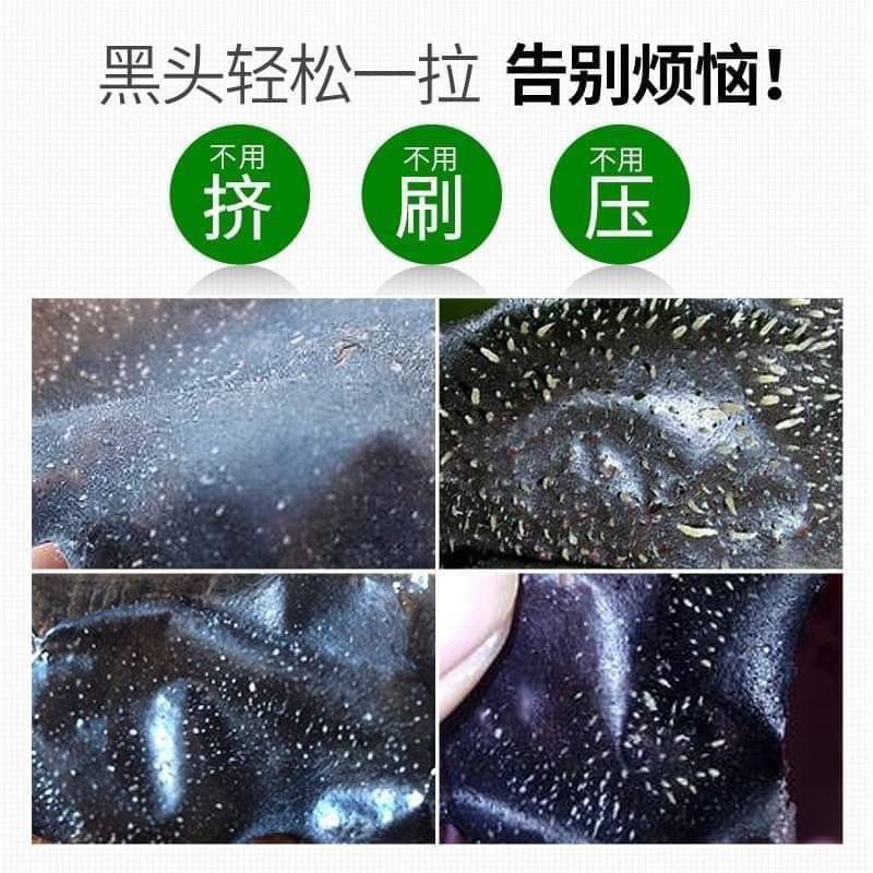 BAMBOOลบCHARCOAL-ADSORPTION-มาร์คลอกสิว-ขายดีอันดับ-1-ในเกาหลี